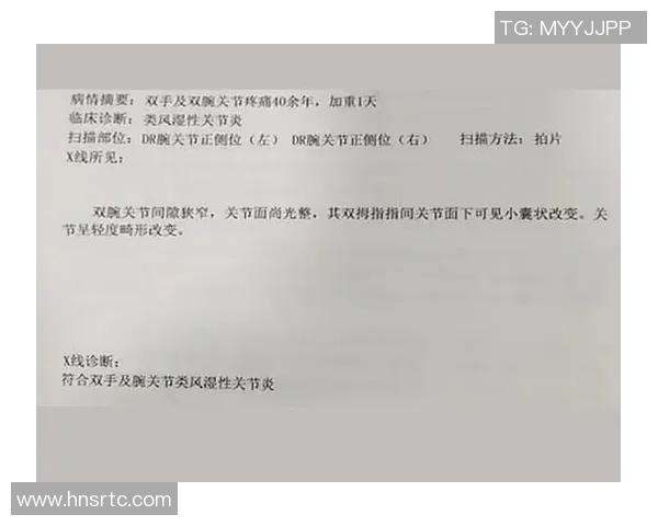 罚球技巧与策略分析探索篮球比赛中罚球对胜负的关键性影响及其应用